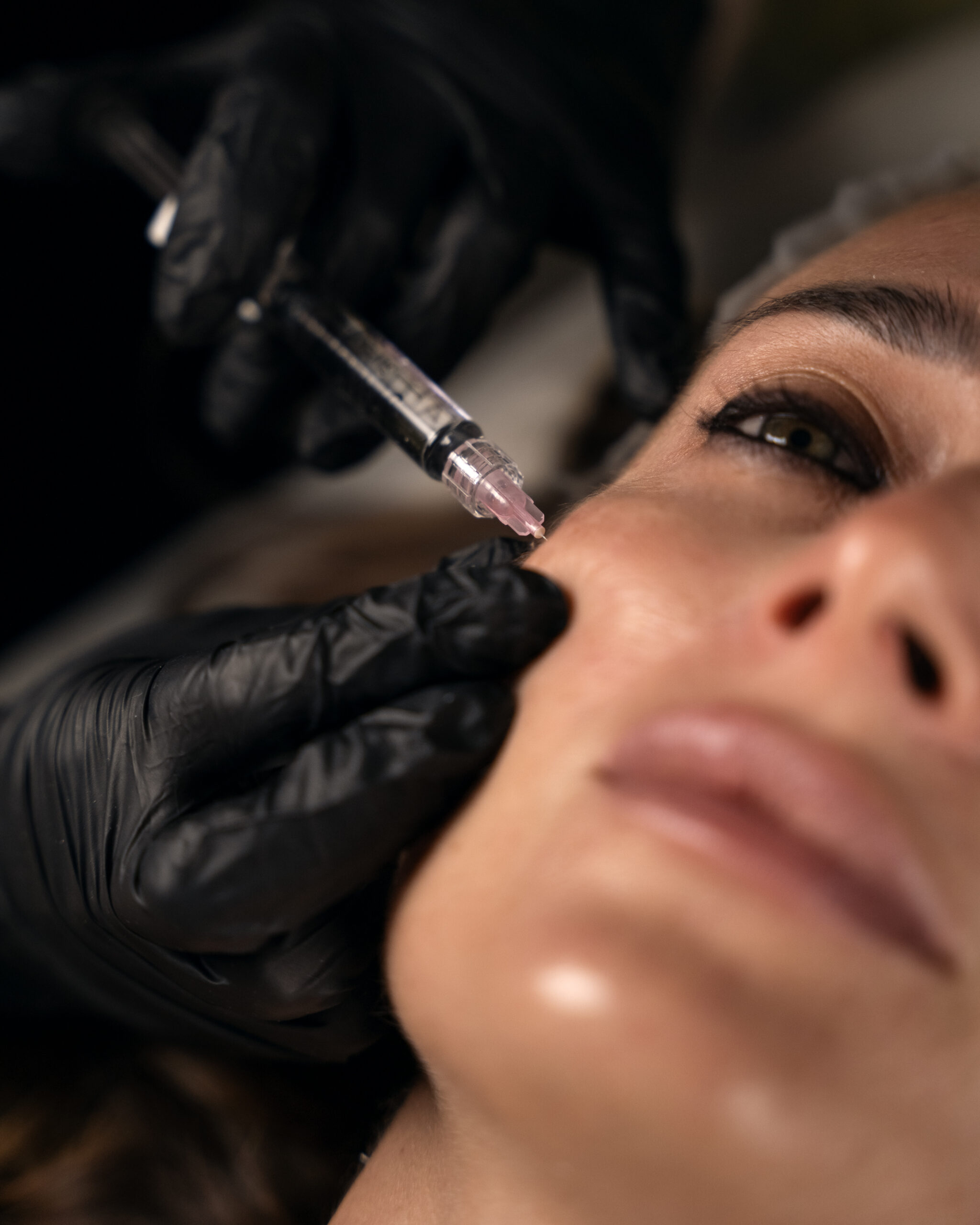 A gloved practitioner holding a syringe near a client’s cheek.